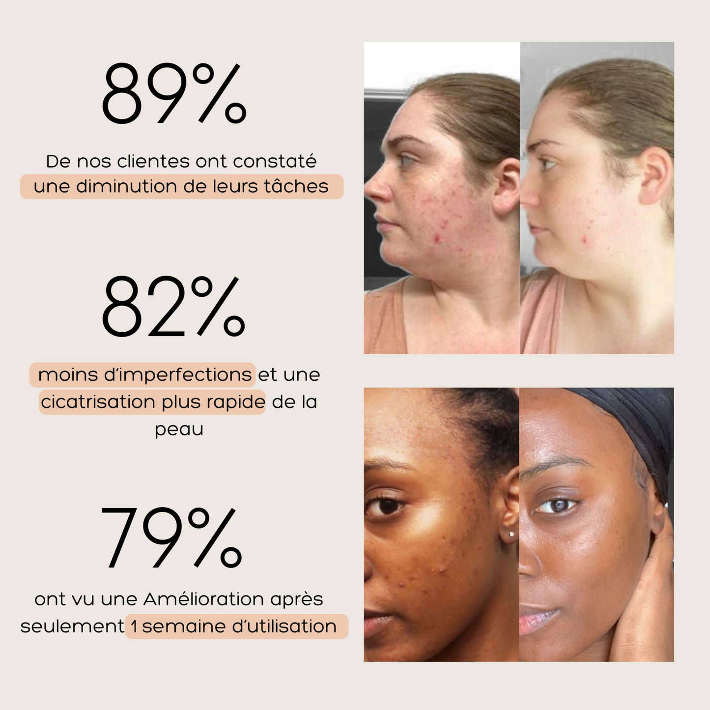 Rutina anti-imperfecciones 4 en 1 / Adios Acne Y Cicatrices