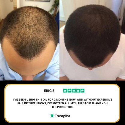 Aceite para el crecimiento del cabello natural Purc™ Resultados en 7 Dias